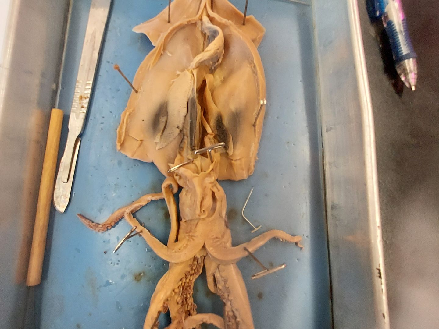 Inside the Mind of a Serial Killer: Uncovering the Dark Secrets of Mindhunter